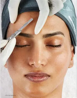 Dermaplaning large